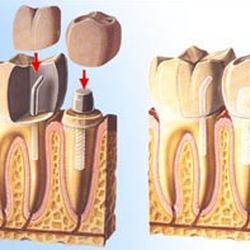David Billings, DDS