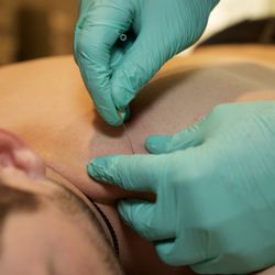 Alternative Pain Solutions