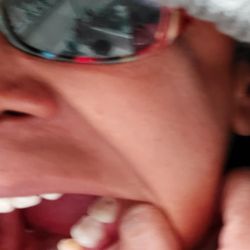 Vistaview Dental Care - Slaughter of my right jaw.