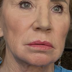 Blue Illusion Beauty - Carlsbad - Trying to contour