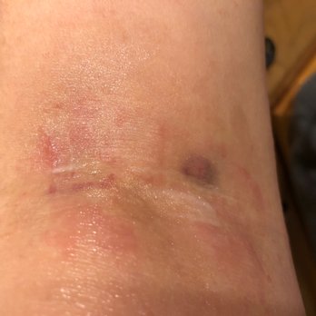 Labcorp - Butchered result from "simple" blood test! - Laboratory Testing Near Me - Freehold, New Jersey