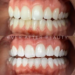 Ever After Beauty - Your smile is your first impression; make it a good one!