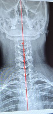 Natural Way Chiropractic of Bellingham