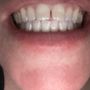 Classic Dental Smiles