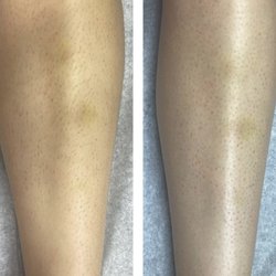 Snatchedandwaxed - Lower leg wax
