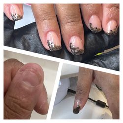 Refresh Nail Bar - Nail biting restoration. Hard gel applied to restore nail bed and lengthen natural nails, 3 months before and after