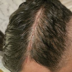 East 50 Barber Shop - Cut on scalp