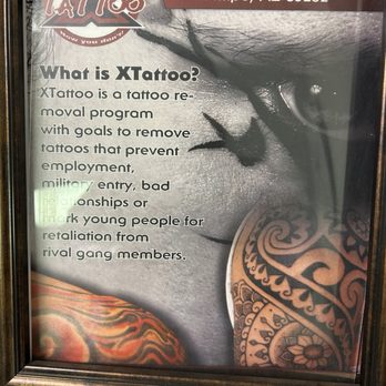 X-Tattoo - A framed poster provides details about tattoo removal services at a business located at 2039 S. Mill Ave., Tempe, AZ, including the process and goals. - Tattoo Removal Near Me - Tempe, Arizona