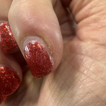 T&N Nails & Spa - More infection starting to happen. I wish I took a picture when it was fully inflamed. It was so painful. - Nail Salons Near Me - Henderson, Nevada T&N Nails & Spa - More infection starting to happen. I wish I took a picture when it was fully inflamed. It was so painful. - Nail Salons Near Me - Henderson, Nevada