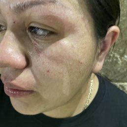 A man beat this woman A man beat this woman