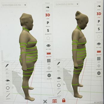 So Cal Slim Clinics - 3D Body Scan - Weight Loss Centers Near Me - Riverside, California So Cal Slim Clinics - 3D Body Scan - Weight Loss Centers Near Me - Riverside, California