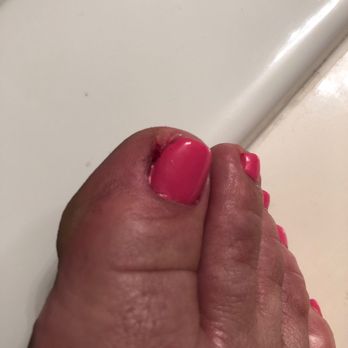 Eric's Nail & Spa - Cut my right big toe and caused it to bleed. - Nail Salons Near Me - Sacramento, California