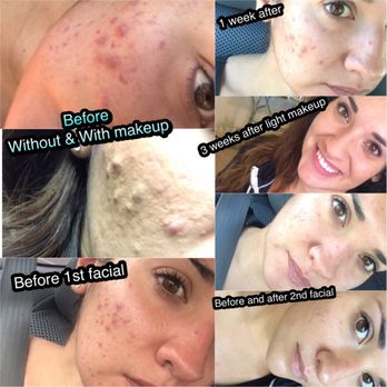 Shaw Skin Clinic - Skin Care Near Me - Albuquerque, New Mexico