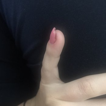 Joy Nails & Spa - The next morning. Swollen possibly needing a visit to the doctor. Painful and red - Nail Salons Near Me - Oceanside, California