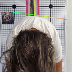 Crockett Family Chiropractic - Scoliosis