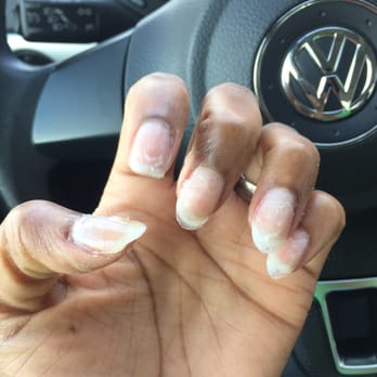 Saigon Nails & Spa - Please DO NOT go here; went in for a $25 full set but came out with lumpy and uneven nails. Went back for a refund and this is what they did - Nail Salons Near Me - Ferndale, Michigan Saigon Nails & Spa - Please DO NOT go here; went in for a $25 full set but came out with lumpy and uneven nails. Went back for a refund and this is what they did - Nail Salons Near Me - Ferndale, Michigan