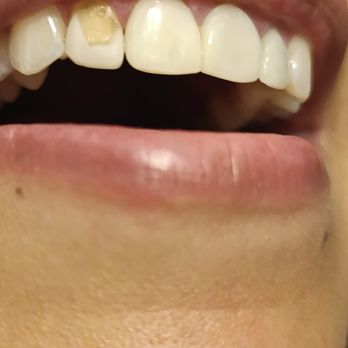 Cancún Dental Specialists - Oral Surgeons Near Me - Cancún, ROO Cancún Dental Specialists - Oral Surgeons Near Me - Cancún, ROO
