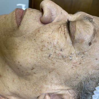 Soft Skin - Before - Waxing Near Me - Southfield, Michigan Soft Skin - Before - Waxing Near Me - Southfield, Michigan