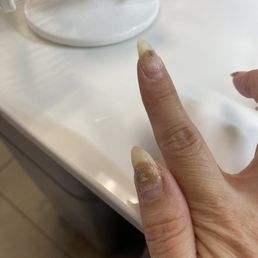 Green nails after gel refill
