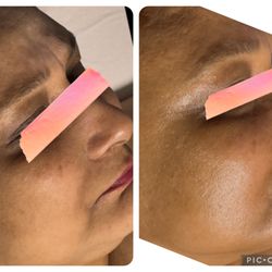 Tiana Marie Esthetics - Give your skin the boost it needs! Our customized facials are curated specifically for you-every visit.
