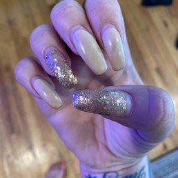 This is a week after getting the gel fill. Looks like it's been a month and they are just so, so bad.