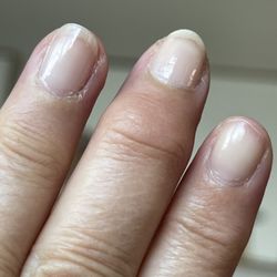 Nails Plus - Peeled/chipped index finger and shredded cuticles