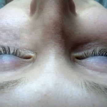 Cheeky Wink - Skin Care Near Me - Berlin, BE