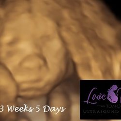 Love View 3D/4D Ultrasound Studio - Love View 3d 4d ultrasound studio