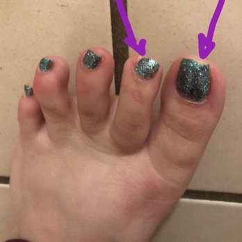 Fancy Nails - Chipped polish after a week - Nail Salons Near Me - Sterling, Virginia