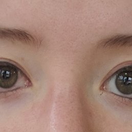 Permanent eyeliner top and bottom (five days after).