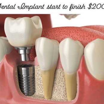 Johnny L Smith, DMD - General Dentistry Near Me - Peoria, Arizona Johnny L Smith, DMD - General Dentistry Near Me - Peoria, Arizona