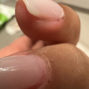 Bambooz Nails - There are the pictures the next day. Right now it doesn't look too bad but gosh they burn!!! and nails are throbbing still. - Nail Salons Near Me - Pico Rivera, California