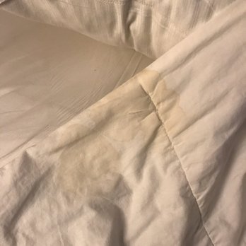 Hotel RL Baltimore Inner Harbor - Stains on linen - Hotels Near Me - Baltimore, Maryland