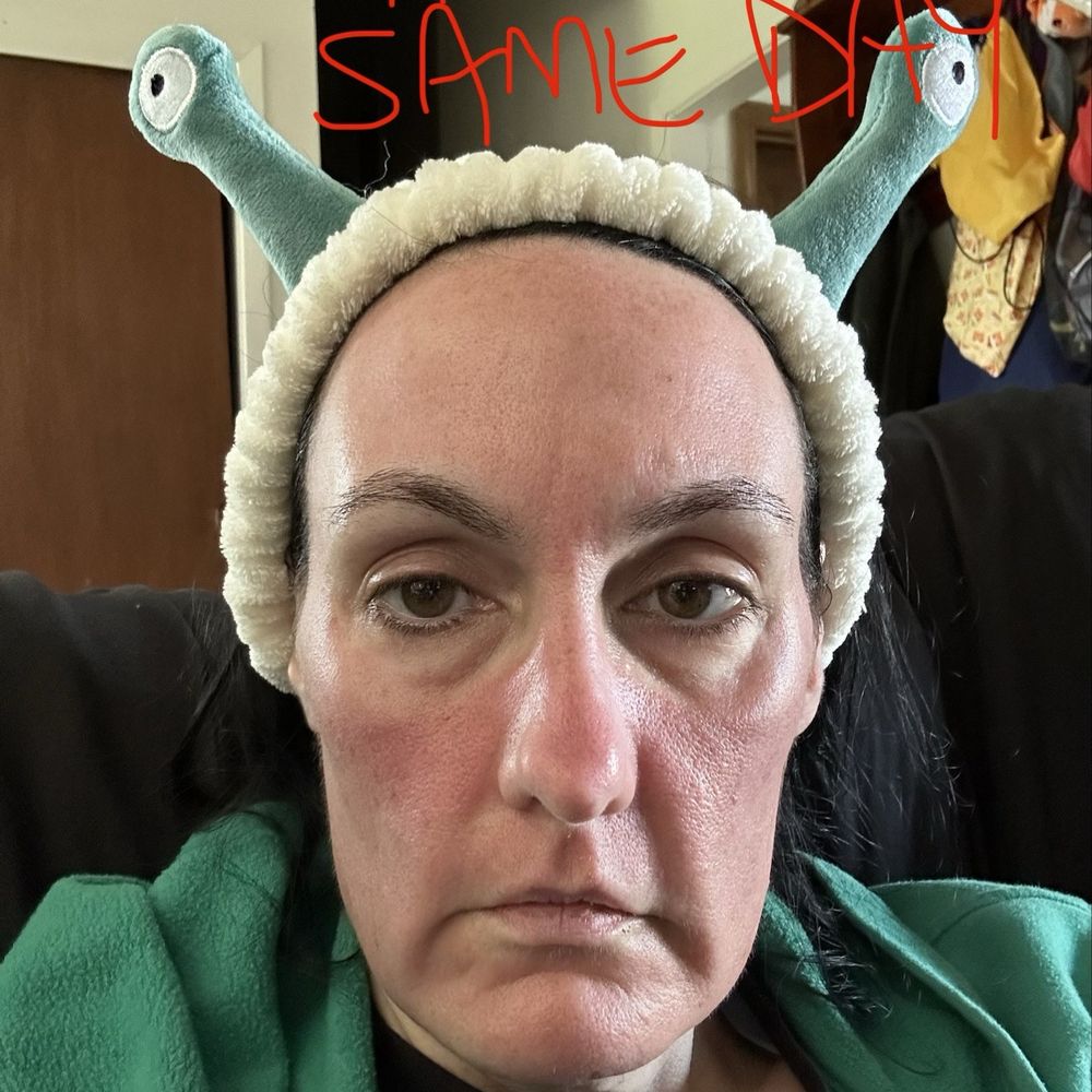 Turkle & Associates - 2 hours after same day treatment- second time - Cosmetic Surgeons Near Me - Carmel, Indiana