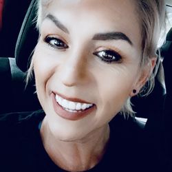 Classy Beauty Clinic - Before lip flip.. no upper lip.