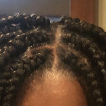 Chantal's Braiding Hair Salon - Knots different sizes and going different directions - Hair Stylists Near Me - Buford, Georgia Chantal's Braiding Hair Salon - Knots different sizes and going different directions - Hair Stylists Near Me - Buford, Georgia