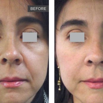 Equilibrium Beauty MD - Medical Spas Near Me - Miami, Florida