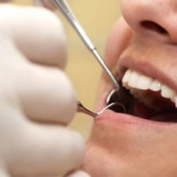 Robert L. Wyler, DDS - Dental Veneers