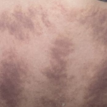 Zhang's Relaxation Centre - Gua sha, acupressure, Thai massage - Massage Near Me - Pittsburgh, Pennsylvania Zhang's Relaxation Centre - Gua sha, acupressure, Thai massage - Massage Near Me - Pittsburgh, Pennsylvania