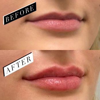 Filter Me Beauty Bar - Skin Care Near Me - Princeton, Texas Filter Me Beauty Bar - Skin Care Near Me - Princeton, Texas