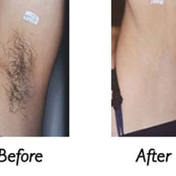 Rio Body Wax - Greenville - Underarms waxing