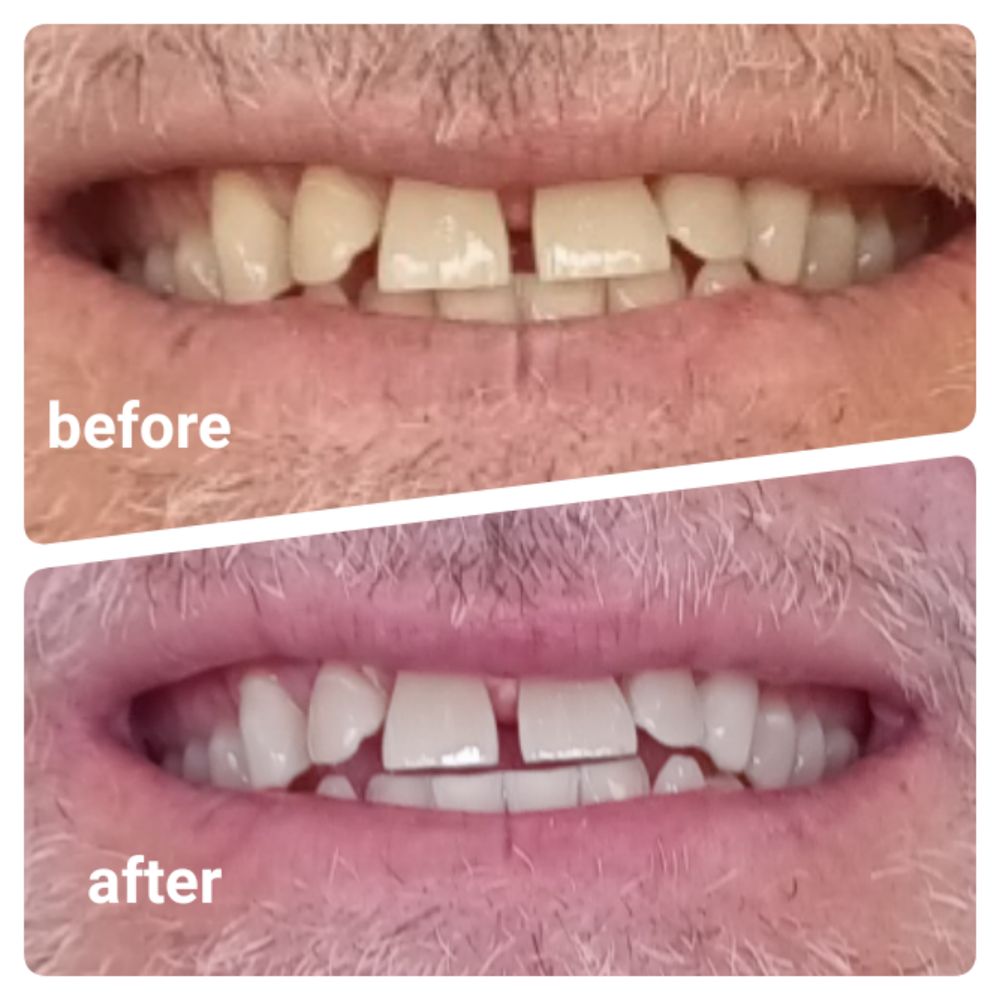 SMILE LABS NAMPA Updated August 2024 Request an Appointment 21