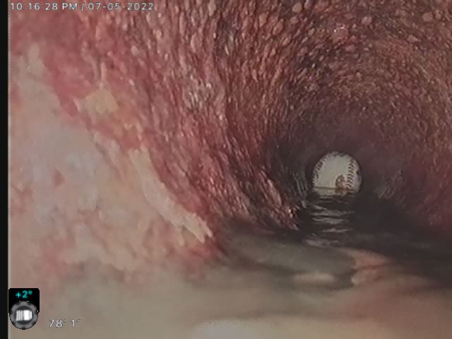 Slide of Totally Stoked Septic & Plumbing Services