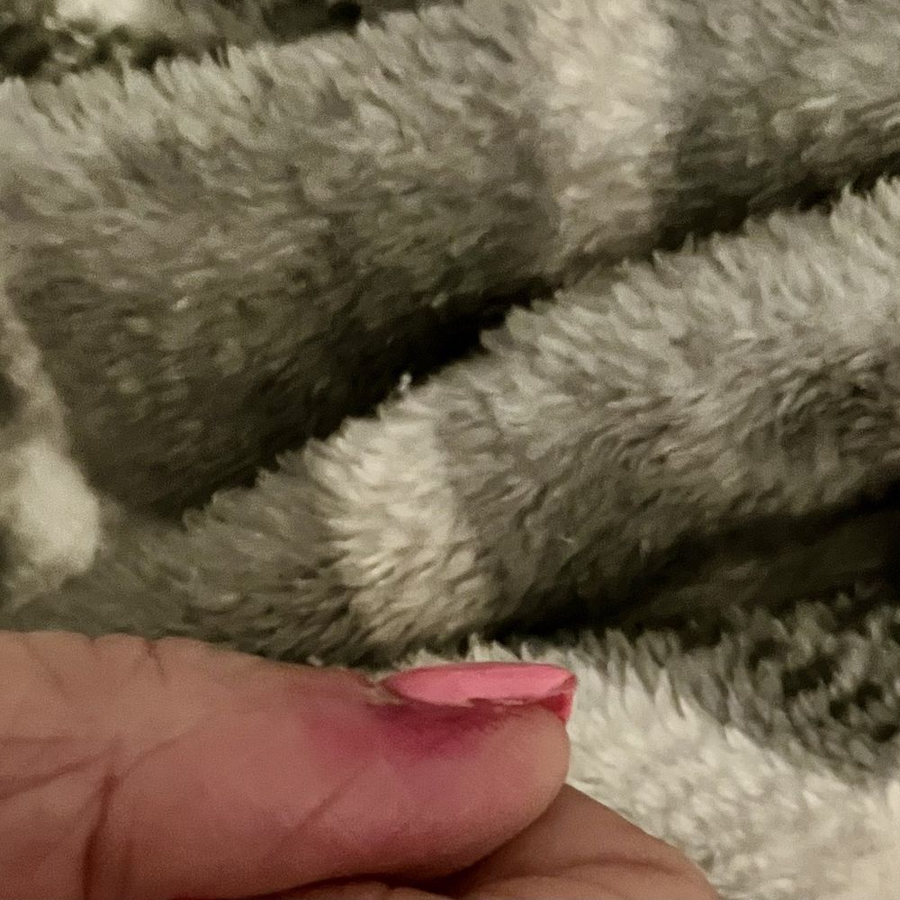 Vanity Nails & Spa - Infection starting in left thumb - Nail Salons Near Me - Las Vegas, Nevada Vanity Nails & Spa - Infection starting in left thumb - Nail Salons Near Me - Las Vegas, Nevada