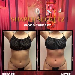 Shaped Secretz Body Sculpting
