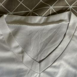 After (v-neckline) After (v-neckline)