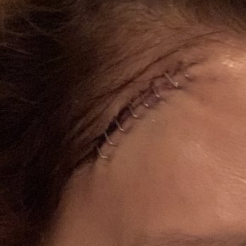 Christopher C. Lo, MD - Los Angeles - Frankenstein staples - Ophthalmologists Near Me - Los Angeles, California Christopher C. Lo, MD - Los Angeles - Frankenstein staples - Ophthalmologists Near Me - Los Angeles, California