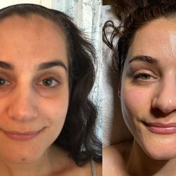 Post Glow. Here we did the Diamond GLow with LED light /Oxygen Add On