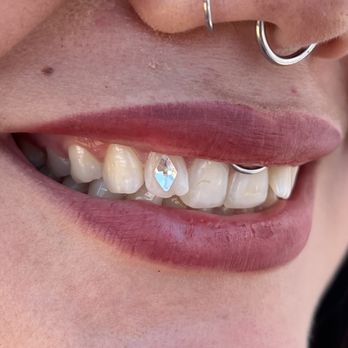 Cute Tooth - Teeth Whitening Near Me - San Diego, California