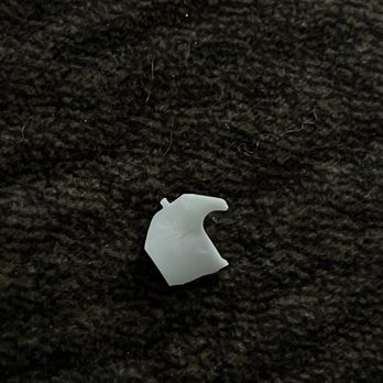 Om Cooking - Hard, sharp plastic that damaged my tooth, and I almost swallowed - Thai Near Me - Wenatchee, Washington Om Cooking - Hard, sharp plastic that damaged my tooth, and I almost swallowed - Thai Near Me - Wenatchee, Washington